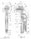 Fig. 12 - Total knee arthroplasty instruments