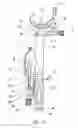 Fig. 13 - Total knee arthroplasty instruments