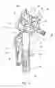 Fig. 14 - Total knee arthroplasty instruments
