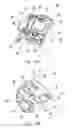 Fig. 15 - Total knee arthroplasty instruments