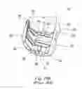 Fig. 19 - Total knee arthroplasty instruments