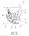 Fig. 20 - Total knee arthroplasty instruments