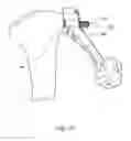 Fig. 24 - Total knee arthroplasty instruments