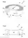 Fig. 03 - Bone implants and methods