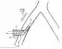 Fig. 01 - System and method for providing access in divergent directions in a vascular environment