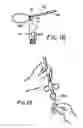 Fig. 16 - Specimen retrieval apparatus and method of use