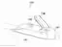 Fig. 01 - Gastric band insertion instrument