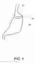 Fig. 02 - Gastric band insertion instrument