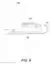 Fig. 08 - Gastric band insertion instrument