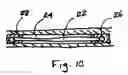 Fig. 03 - Anastomosis device catheter and sheath constructions