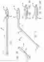 Fig. 02 - Multi-functional medical instrument and methods of use