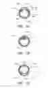 Fig. 05 - Expandable percutaneous sheath