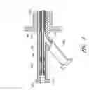 Fig. 08 - Expandable percutaneous sheath