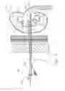 Fig. 10 - Expandable percutaneous sheath