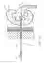 Fig. 12 - Expandable percutaneous sheath