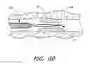 Fig. 09 - Method and apparatuses for treating an intravascular occlusion