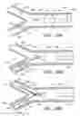 Fig. 24 - Method and apparatuses for treating an intravascular occlusion