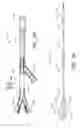 Fig. 30 - Method and apparatuses for treating an intravascular occlusion