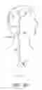 Fig. 40 - Method and apparatuses for treating an intravascular occlusion