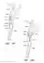Fig. 47 - Method and apparatuses for treating an intravascular occlusion