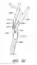 Fig. 50 - Method and apparatuses for treating an intravascular occlusion