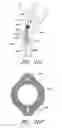 Fig. 57 - Method and apparatuses for treating an intravascular occlusion