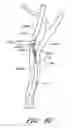 Fig. 58 - Method and apparatuses for treating an intravascular occlusion