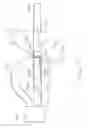 Fig. 06 - Remote body tissue engaging methods and apparatus