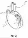 Fig. 09 - Hermetic implantable stimulator