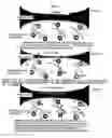 Fig. 02 - Electromagnetic stimulation in patients with osteoporosis