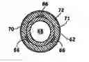 Fig. 01 - Extensible implantable medical lead