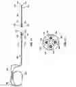 Fig. 07 - Extensible implantable medical lead
