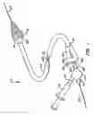 Fig. 02 - Stent deployment systems and methods