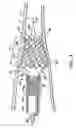Fig. 04 - Stent deployment systems and methods