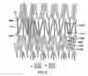 Fig. 07 - Expandable Stent And Method For Delivery Of Same