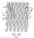 Fig. 08 - Expandable Stent And Method For Delivery Of Same