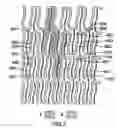 Fig. 09 - Expandable Stent And Method For Delivery Of Same
