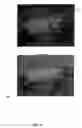 Fig. 13 - Covering for an endoprosthetic device and methods of using for aneurysm treatment