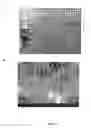 Fig. 14 - Covering for an endoprosthetic device and methods of using for aneurysm treatment