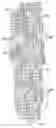 Fig. 01 - Optimally expanded, collagen sealed ePTFE graft with improved tissue ingrowth