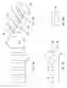 Fig. 09 - Intermediate bone block and its use in bone block assemblies and assembled bone-tendon-bone grafts
