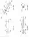 Fig. 30 - Intermediate bone block and its use in bone block assemblies and assembled bone-tendon-bone grafts