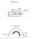 Fig. 03 - Vertebral motion preservation device with improved rotational motion