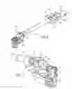 Fig. 04 - Vertebral replacement and distraction device for placing said implant