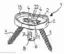 Fig. 01 - Prosthesis for the glenoid cavity of the scapula