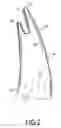 Fig. 03 - Heatproof mitten