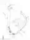 Fig. 03 - Multi-purpose cooking utensil