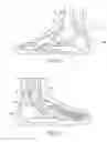 Fig. 05 - Contoured skate boot