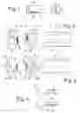 Fig. 02 - Master-keyed cylinder comprising tumblers and corresponding master key