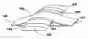Fig. 01 - Device for fixing a module to the surface of a tire
